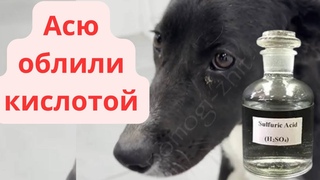 Асю облили кислотой 😰