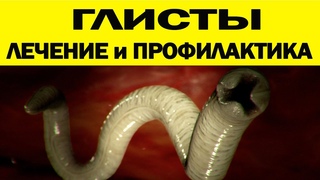 АНАЛИЗЫ - НЕ РАБОТАЮТ!   СИМПТОМЫ, ПРОФИЛАКТИКА, ЛЕЧЕНИЕ от глистов - всё в одном видео !!!