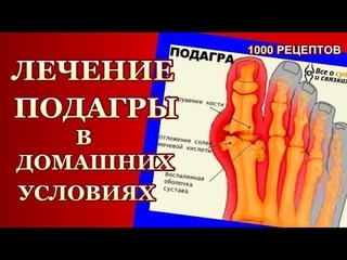 ВЫВОДИМ МОЧЕВУЮ КИСЛОТУ  из ОРГАНИЗМА  В ДОМАШНИХ УСЛОВИЯХ ЛЕЧЕНИЕ ПОДАГРЫ  ПРИМОЧКИ,КОМПРЕССЫ