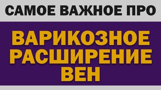 Варикозное расширение вен: Самое важное (Причины, операция, гели, бельё, упражнения)